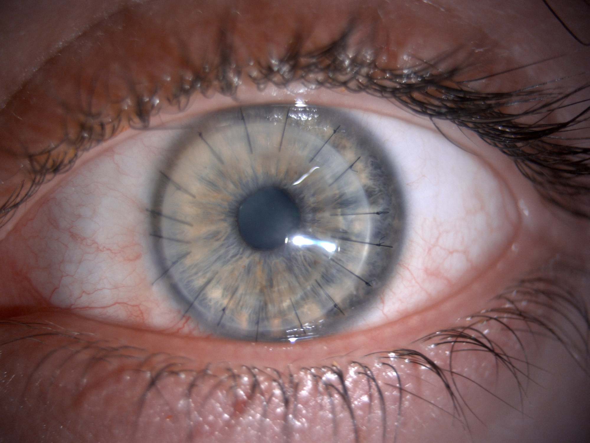 Sử dụng da heo trong chế tạo giác mạc cấy ghép, các nhà khoa học lấy lại được thị lực cho bệnh nhân khiếm thị-3