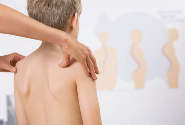 Các yếu tố gây gù vẹo cột sống ở trẻ em, cha mẹ cần biết-4