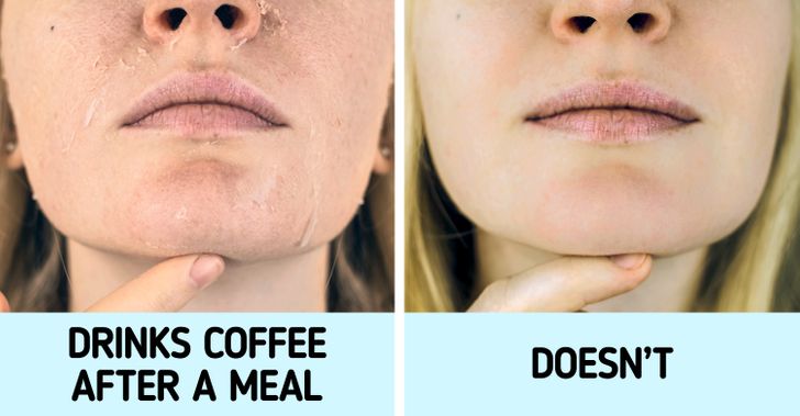 Đừng uống cà phê sau bữa ăn vì hành động này vô tình khiến cơ thể bạn gặp nguy hiểm không ngờ đến-1