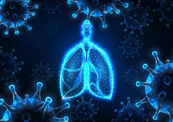 3 tổn thương phổi nghiêm trọng do Covid-19-1