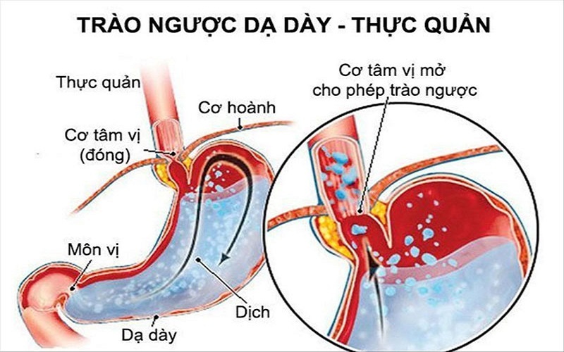 Căn bệnh khiến Hà Tăng ngày càng gầy, có nguy cơ biến chứng cao, nhiều người dễ mắc phải-4