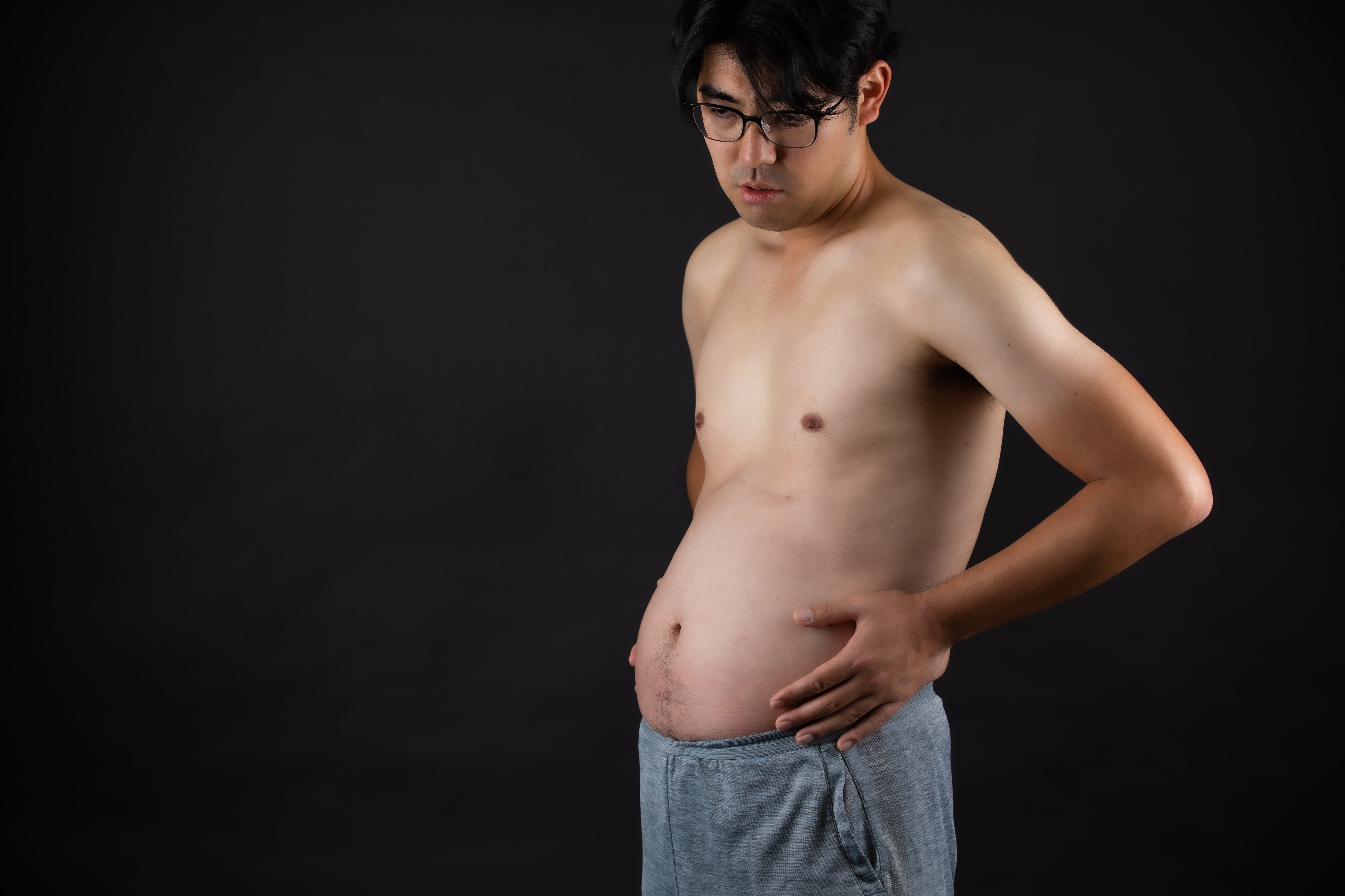 Thừa cân, béo phì gây ung thư ở người trẻ-1