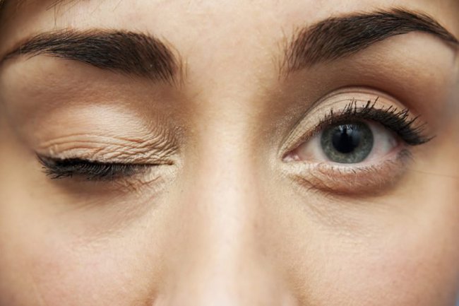 Nhiều người làm động tác này để giảm mỏi mắt mà không biết có thể gây biến dạng nhãn cầu-4