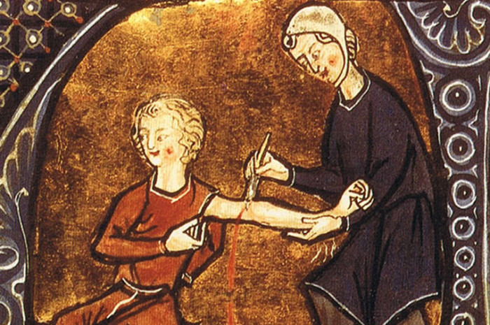 5 kỹ thuật y học kì lạ thời cổ đại, ai biết đến cũng thấy rùng mình-1